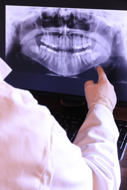 Best Dental Abscess Treatment in Issaquah, WA